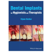 Dental Implants for Hygienists and Therapists