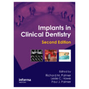 Implants in Clinical Dentistry