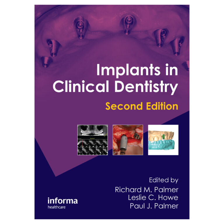 دانلود کتاب Implants in Clinical Dentistry پاپیروس