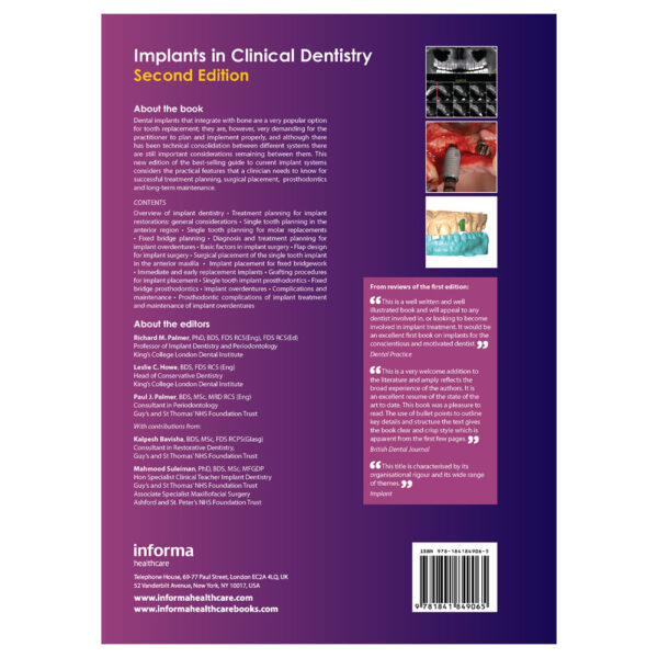 Implants in Clinical Dentistry back cover
