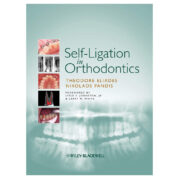 Self-Ligation in Orthodontics