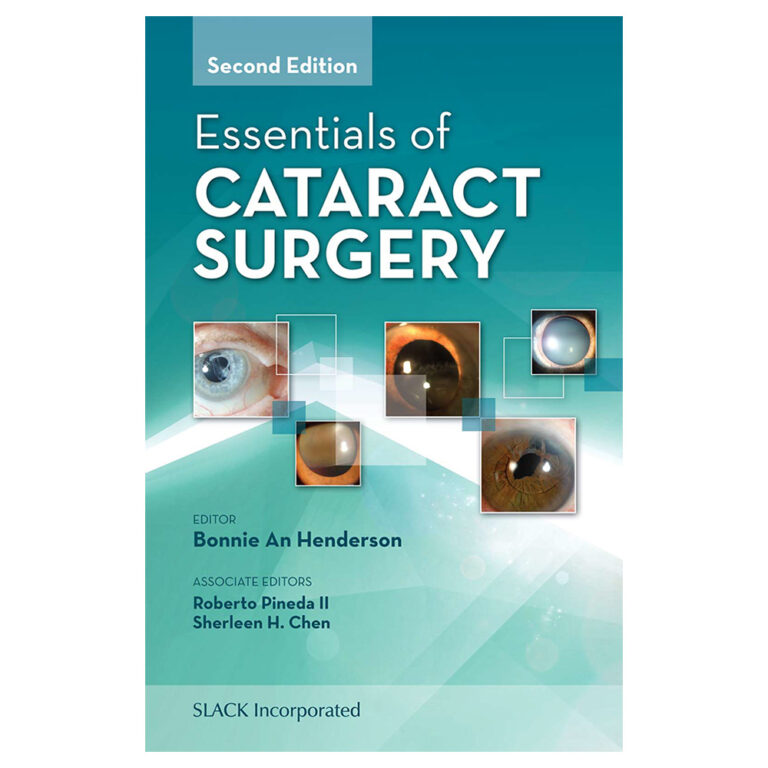 دانلود کتاب Essentials of Cataract Surgery پاپیروس