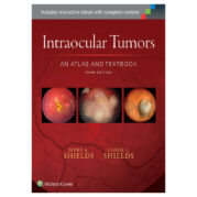 Intraocular Tumors: An Atlas and Textbook