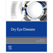 Dry Eye Disease