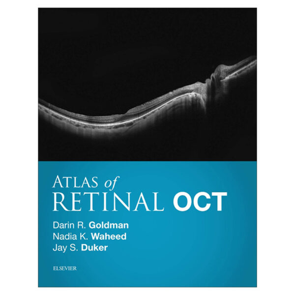 Atlas of Retinal OCT