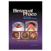 Bimanual Phaco