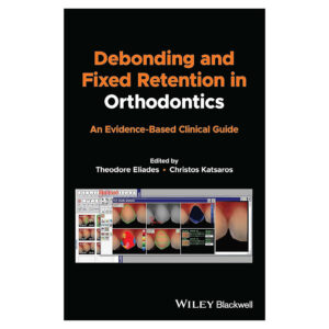 Debonding and Fixed Retention in Orthodontics