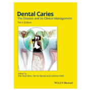 Dental Caries: The Disease and its Clinical Management