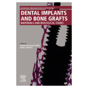 Dental Implants and Bone Grafts