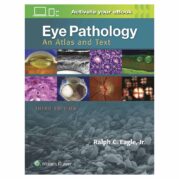 Eye Pathology