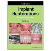 Implant Restorations