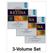 Ryan's Retina