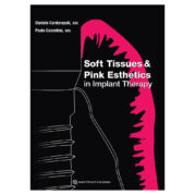 Soft Tissues and Pink Esthetics in Implant Therapy